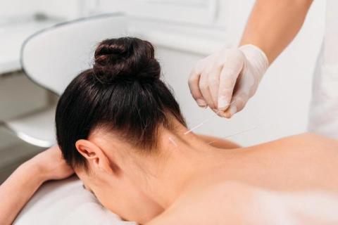 Acupuncture for Pain, Stress, and Better Sleep